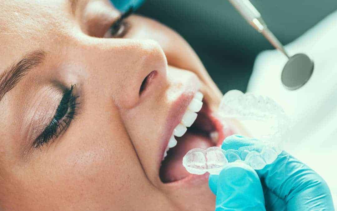Mulher realizando um tratamento de Clareamento Dental | Ianara Pinho