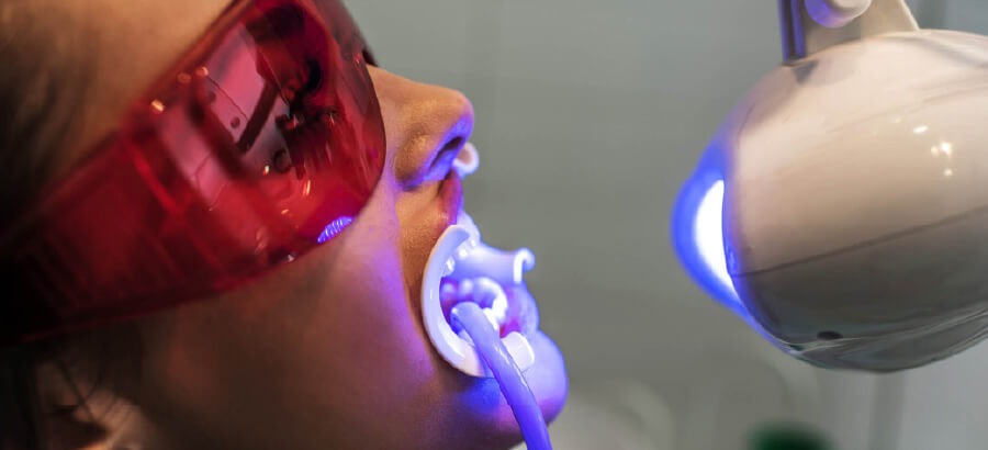 Conheça os principais tratamentos de estética dental