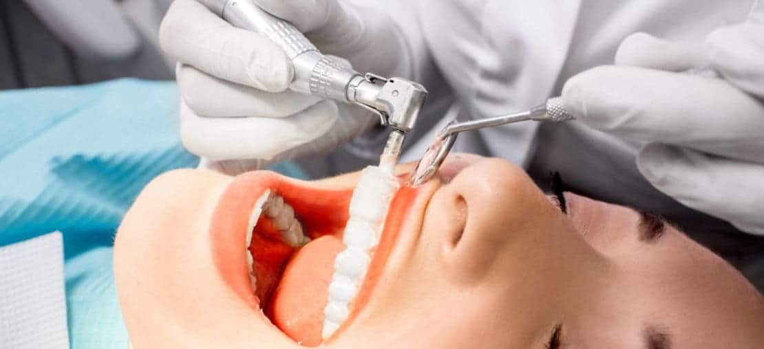 Profilaxia Dentária: tire suas dúvidas sobre essa limpeza indispensável!