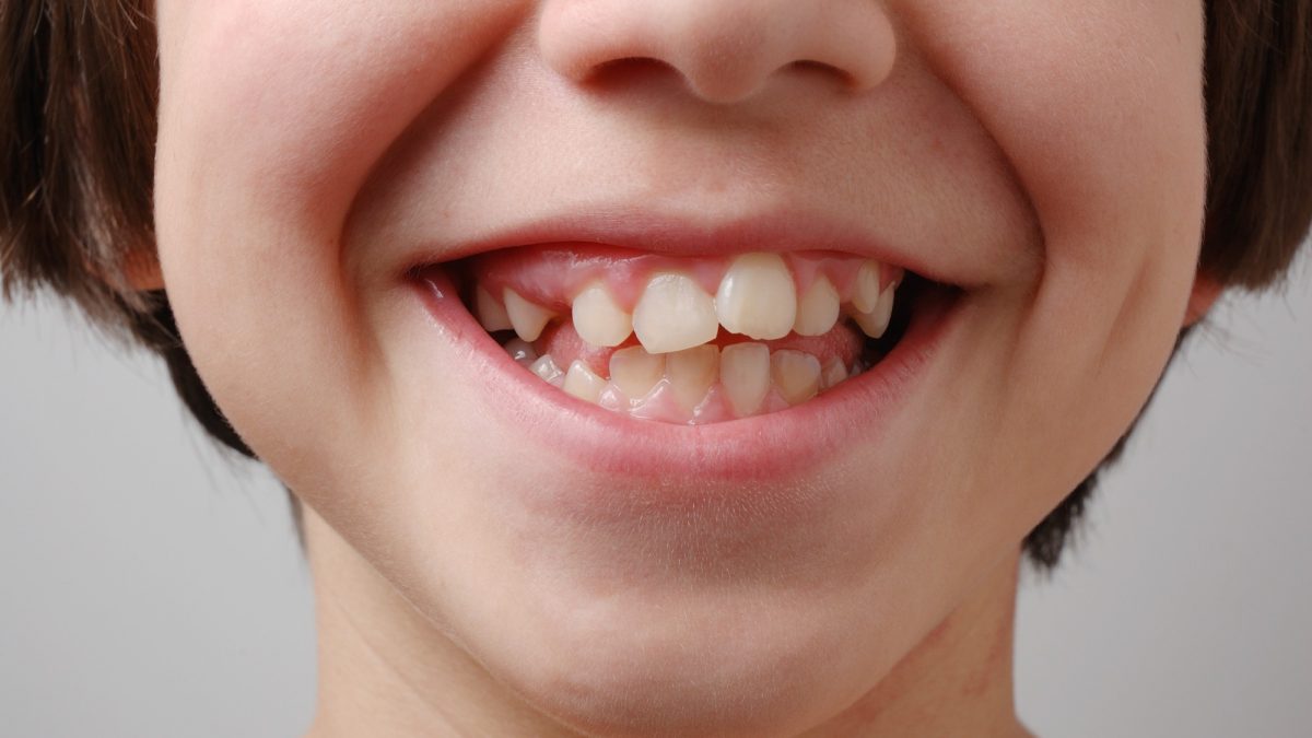 várias bocas em posições diferentes. com dentes, língua, sorriso