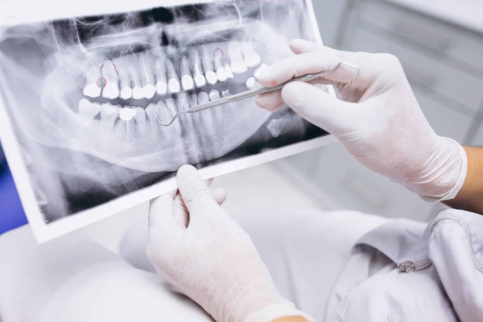 Radiologia Odontológica em Brasília: seu atendimento completo é aqui