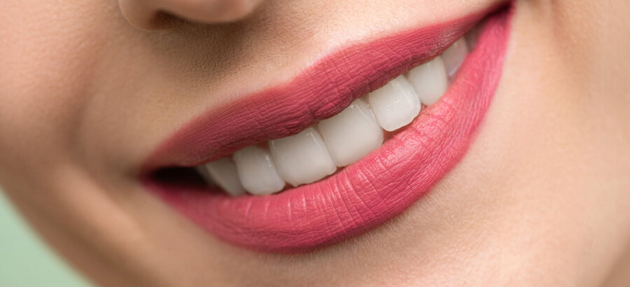 Clareamento Dental: cuidados após o tratamento