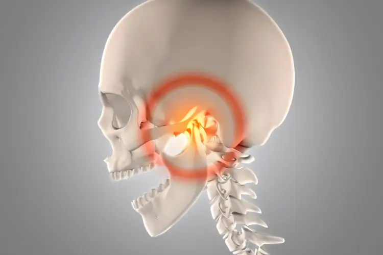 Ilustração da articulação temporomandibular com destaque em vermelho indicando dor na DTM.Ilustração da articulação temporomandibular com destaque em vermelho indicando dor na DTM