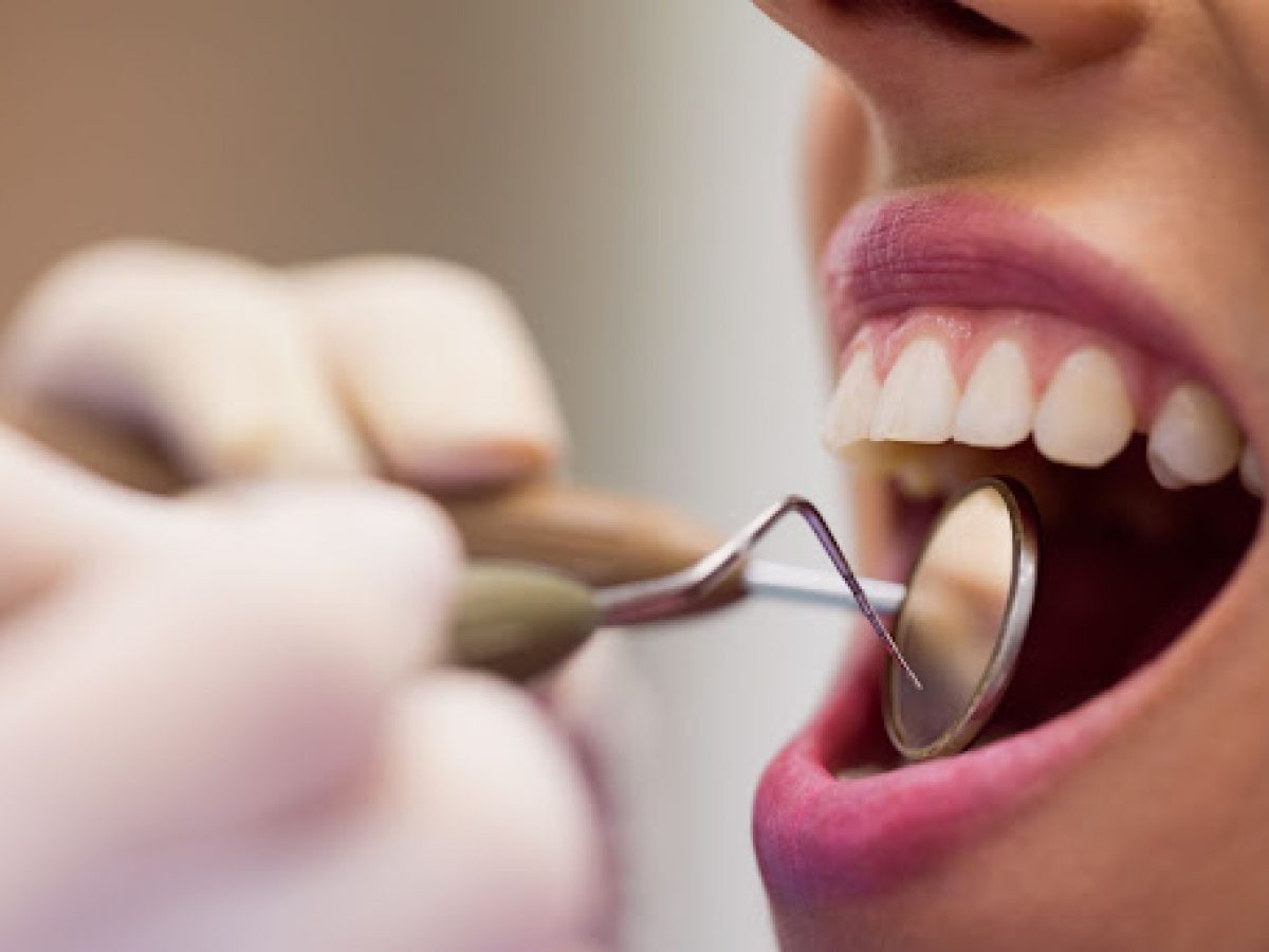 Dor em vários dentes ao mesmo tempo – qual pode ser a causa