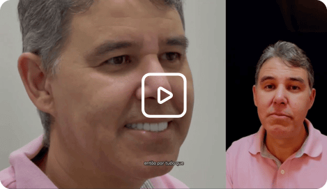 Transformação do Walter - Lentes de Contato Dental em Brasília com a Ianara Pinho Odontologia