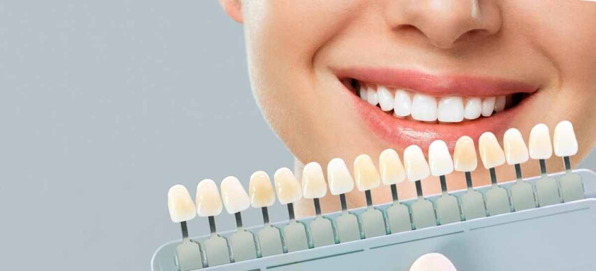 Mulher sorrindo com dentes brancos perfeitos e segurando uma amostra de coroas de porcelana