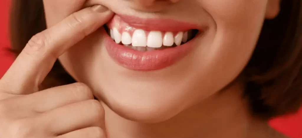 Gengiva escura: o que é, quais as principais causas e como prevenir?