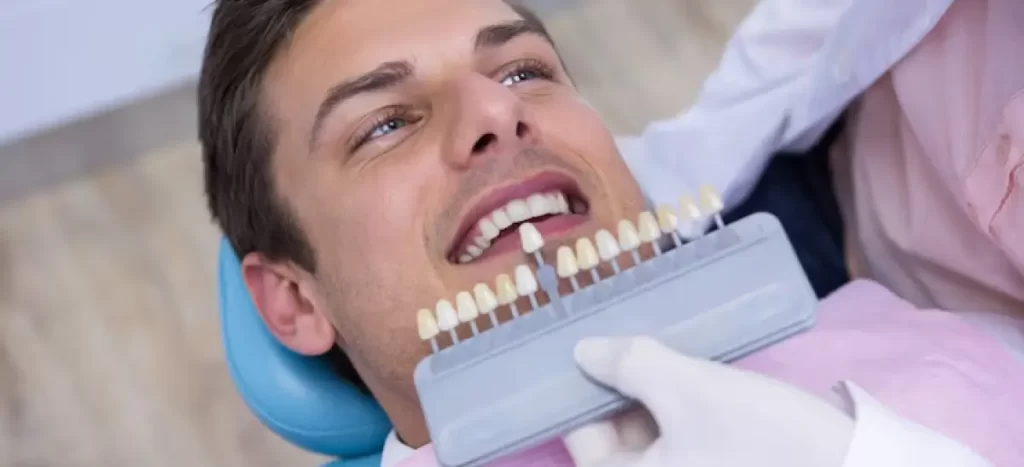 É necessário desgastar os dentes ao colocar lentes de contato dental?