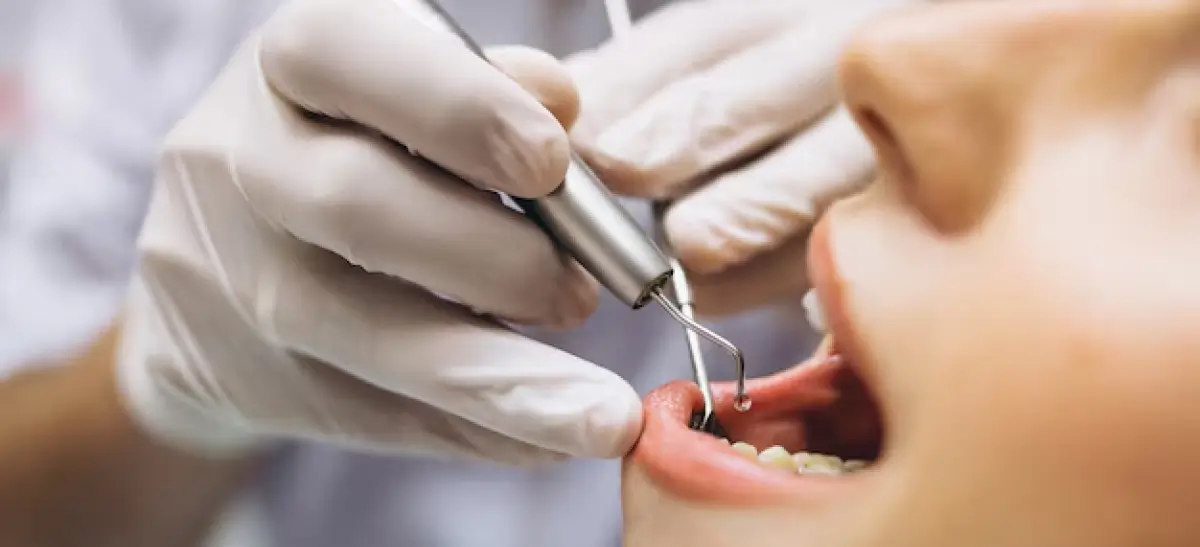 Paciente no dentista, realizando consulta de rotina para identificar problemas como necrose pulpar