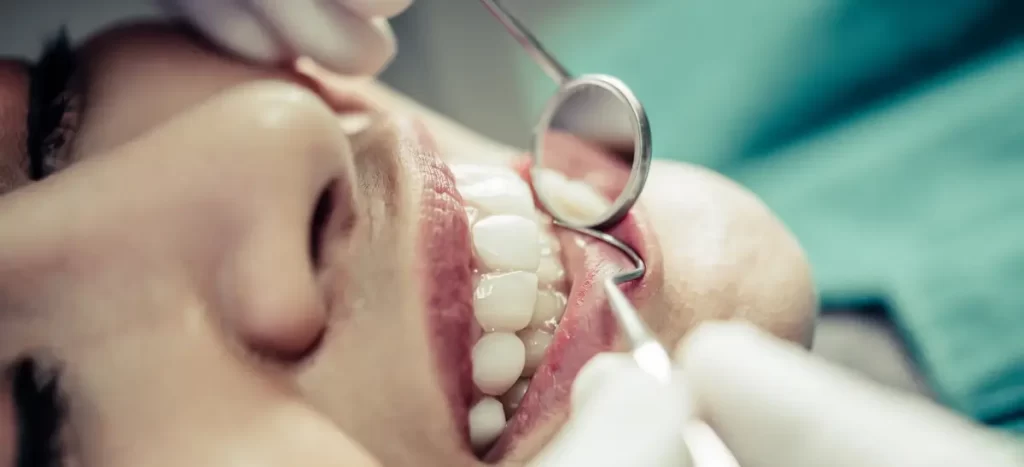 Cirurgia periodontal: o que é, tipos, benefícios e principais cuidados