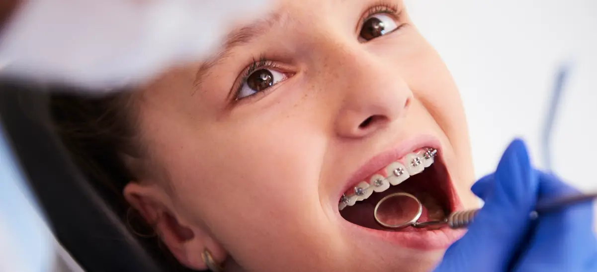 Jovem no consultório odontológico utilizando uma alternativa moderna ao aparelho freio de burro