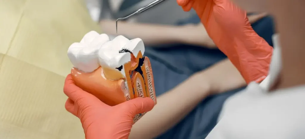 Raiz do dente exposta: quais são as causas, sintomas e tratamento